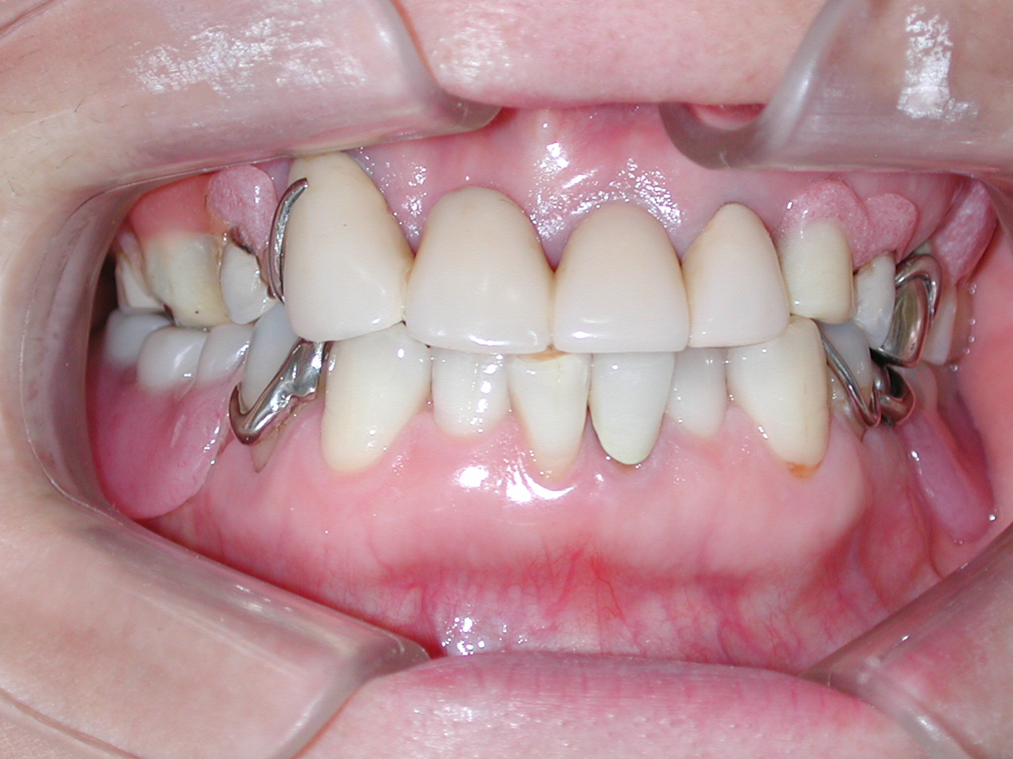 値段 歯石 取り 歯のホワイトニングと歯石取りの値段について教えて下さい